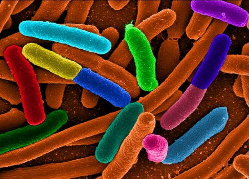  Escherichia coli